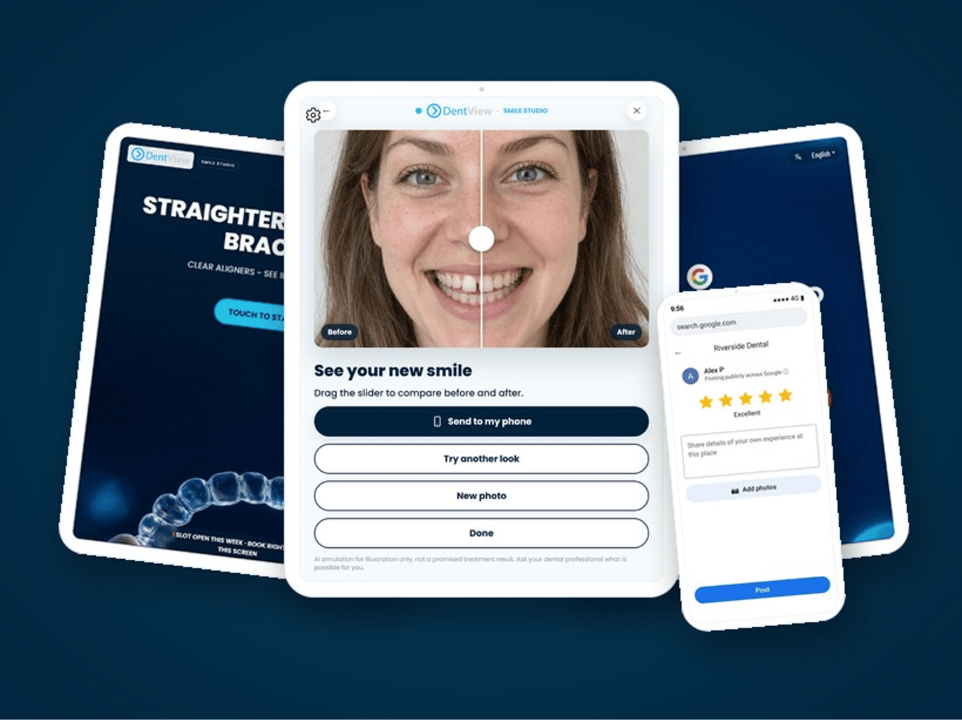 Die DentView Smile Studio-App mit „Smile Preview“ im App Store und bei Google Play von DentView Oy