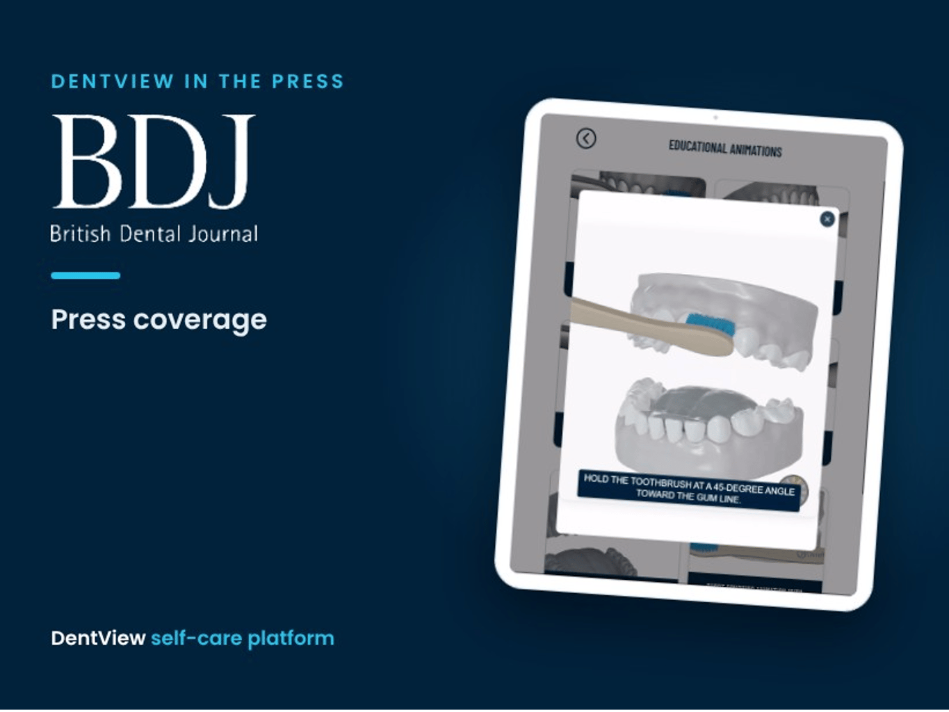 BDJ: Digitales Tool unterstützt die Mundgesundheit bei kieferorthopädischen Patienten von DentView Oy