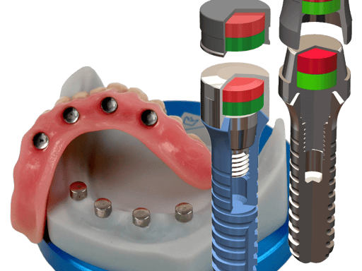 Titanmagnetics® – steco-system-technik GmbH & Co. KG
