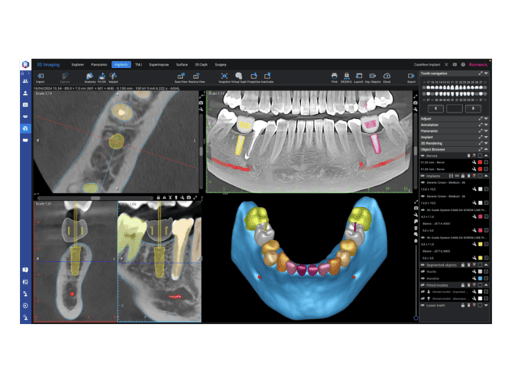 Planmeca Romexis® – All-in-one software for dentistry – Planmeca Oy