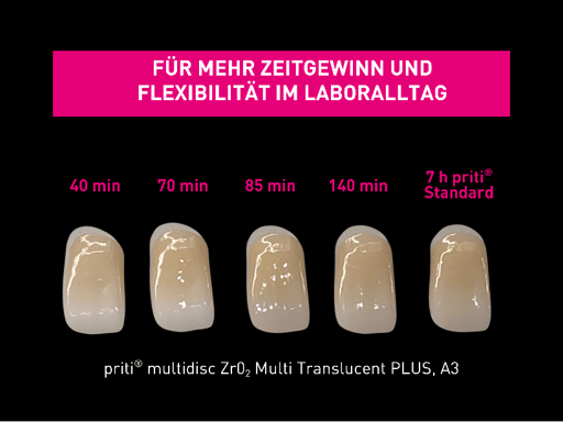 Speedsintern: Jetzt noch schneller im Sinterprozess – Pritidenta GmbH