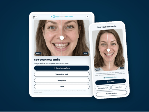 Smile Preview - AI smile illustration on the patient phone – DentView Oy