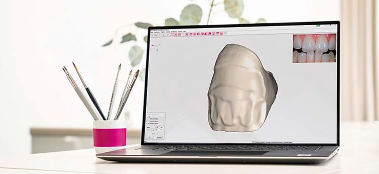 ceraMotion® CADback von DENTAURUM GmbH & Co. KG – Bild 2