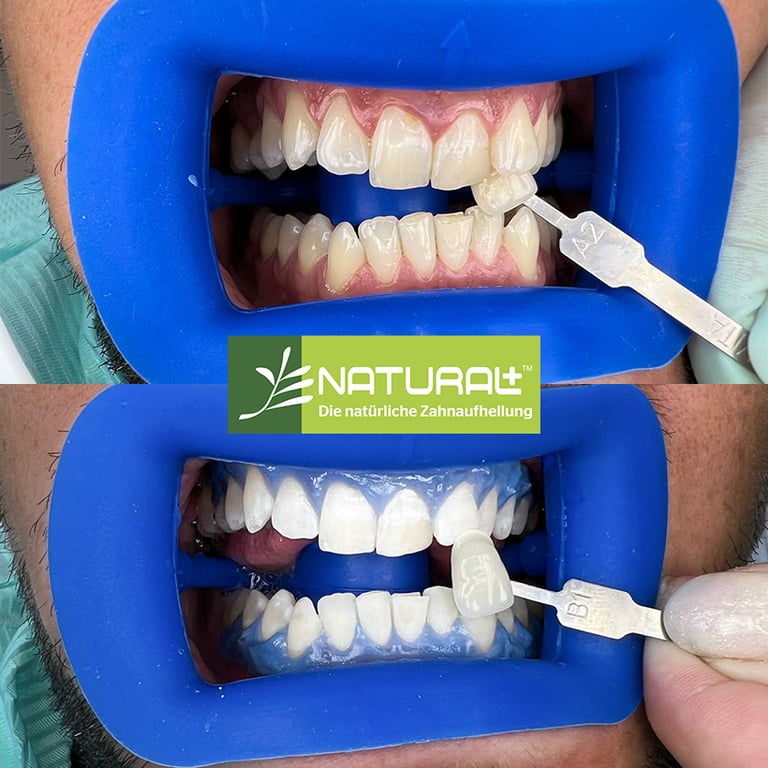 NATURAL+ von Bisico Bielefelder Dentalsilicone GmbH & Co. KG – Bild 2