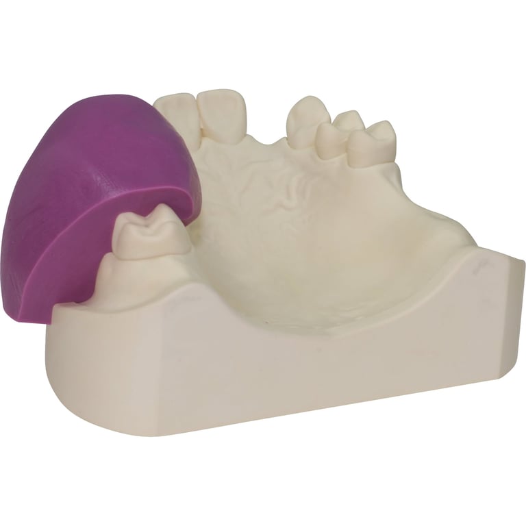 Fegura Sil putty von Feguramed GmbH – Bild 2