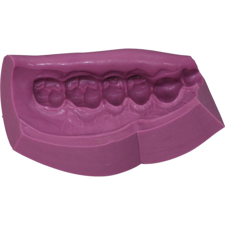 Fegura Sil putty von Feguramed GmbH – Bild 3