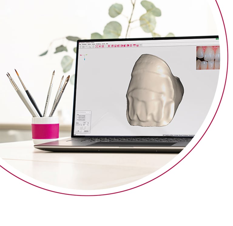 ceraMotion® CADback von DENTAURUM GmbH & Co. KG