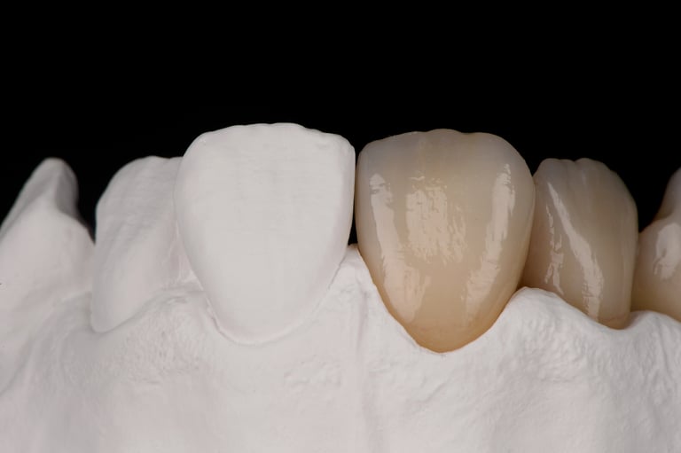 priti® multidisc ZrO₂ MT von Pritidenta GmbH – Bild 3