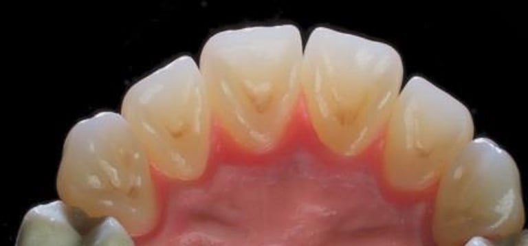 priti® multidisc ZrO₂ HT von Pritidenta GmbH – Bild 5