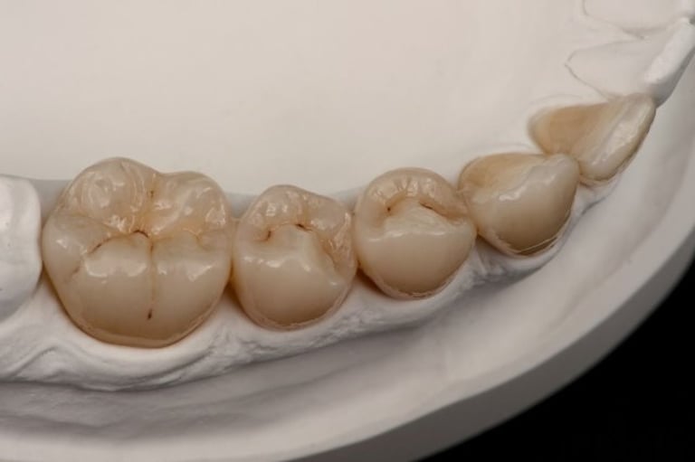 priti® multidisc ZrO₂ ET von Pritidenta GmbH – Bild 4