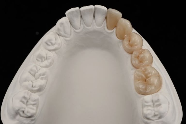 priti® multidisc ZrO₂ ET von Pritidenta GmbH – Bild 5